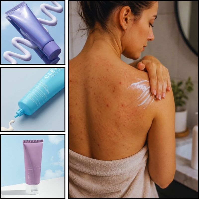 Gia Công Kem Trị Mụn Lưng Trọn Gói